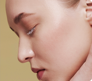  - بعد از درمان